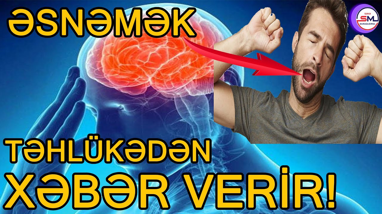 Əsnəmək təhlükəli xəstəlikdən xəbər verir – DİQQƏT!