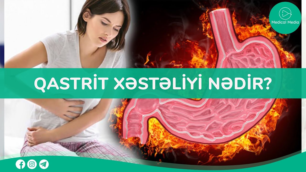 Qastroenteroloqun qəbulu - Qastrit xəstəliyi nədir?