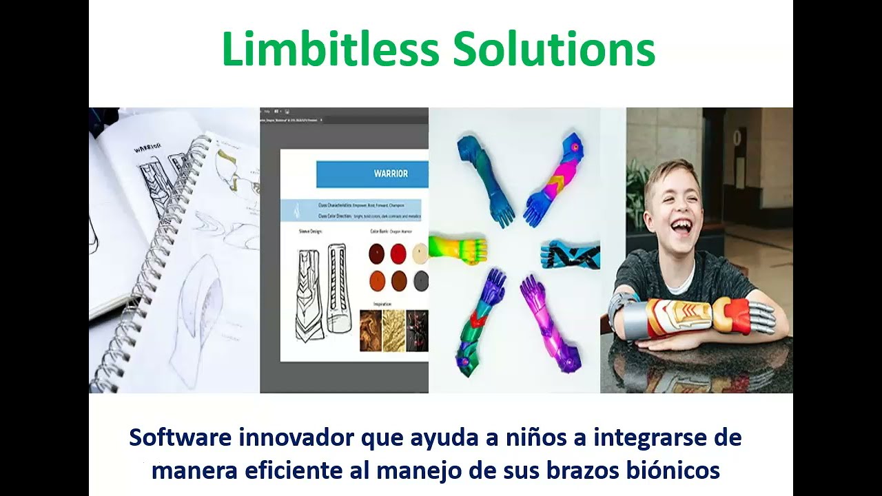 Software innovador ayuda a ni&ntilde;os a integrarse de manera eficiente al manejo de sus brazos bi&oacute;nicos
