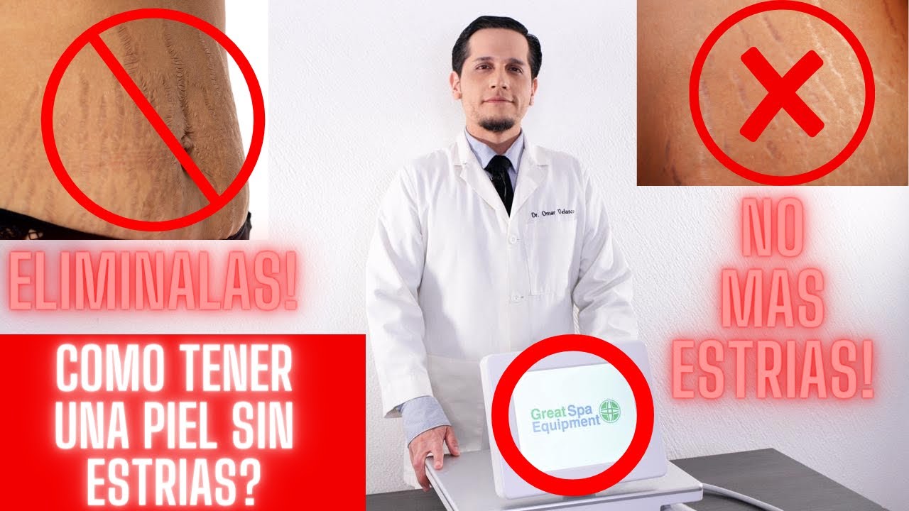 COMO ELIMINAR ESTRIAS?
