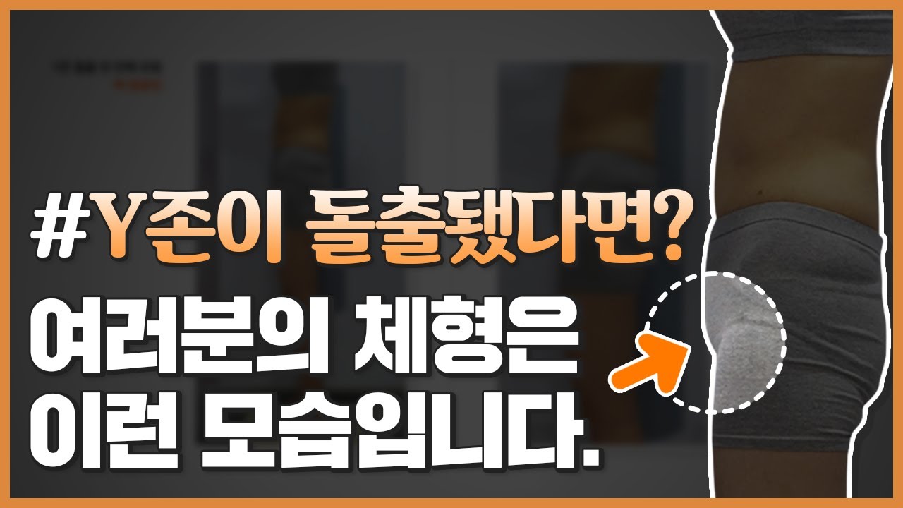Y존(치골,음부)돌출 된 분의 진짜 체형문제!