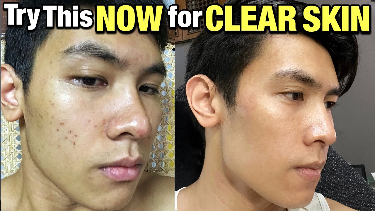 Everyday Skin Care Routine For Men || Philippines