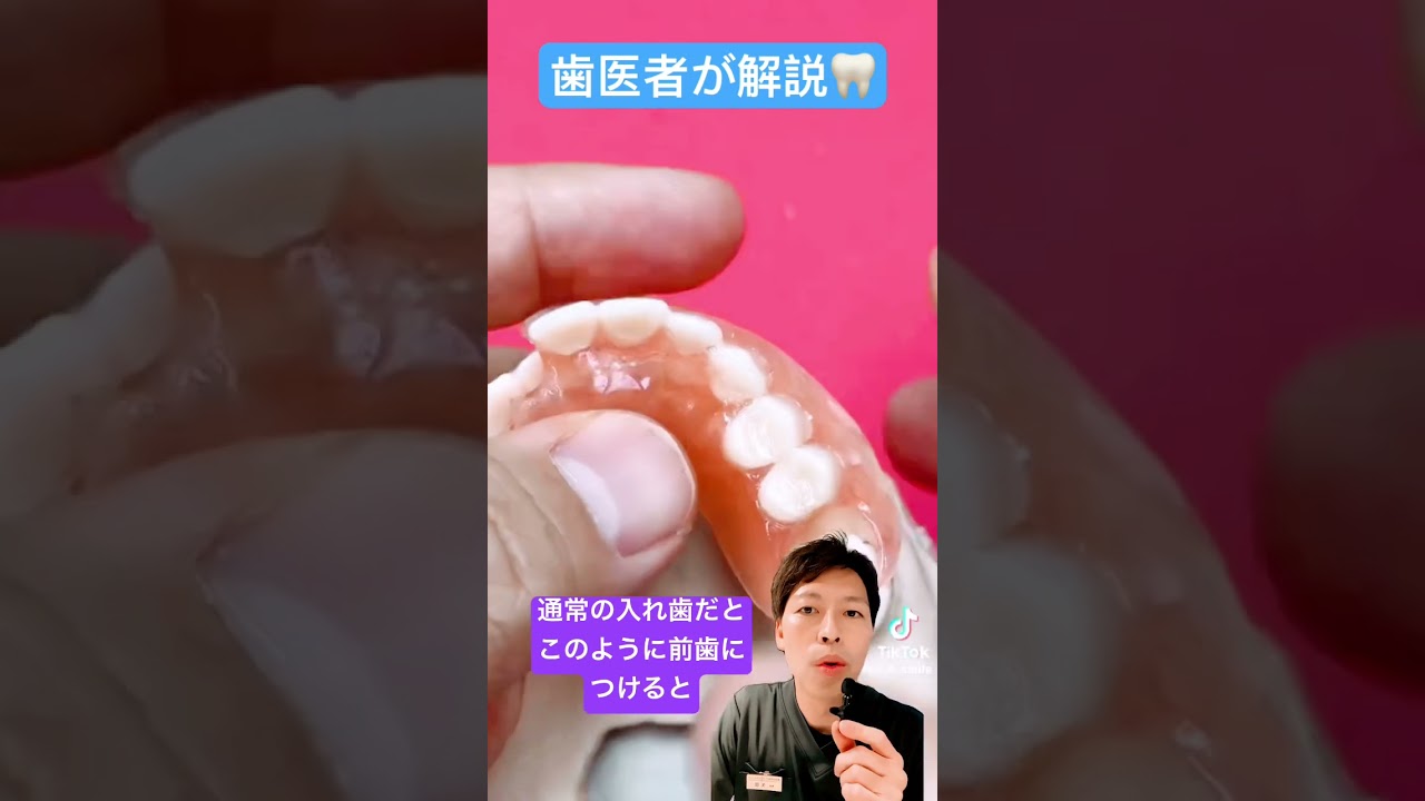 ノンクラスプデンチャー🦷#入れ歯 #目立たない #インプラント #ブリッジ #歯医者 #セラミック治療  #歯並び #ソケット #ミラクルデンチャー