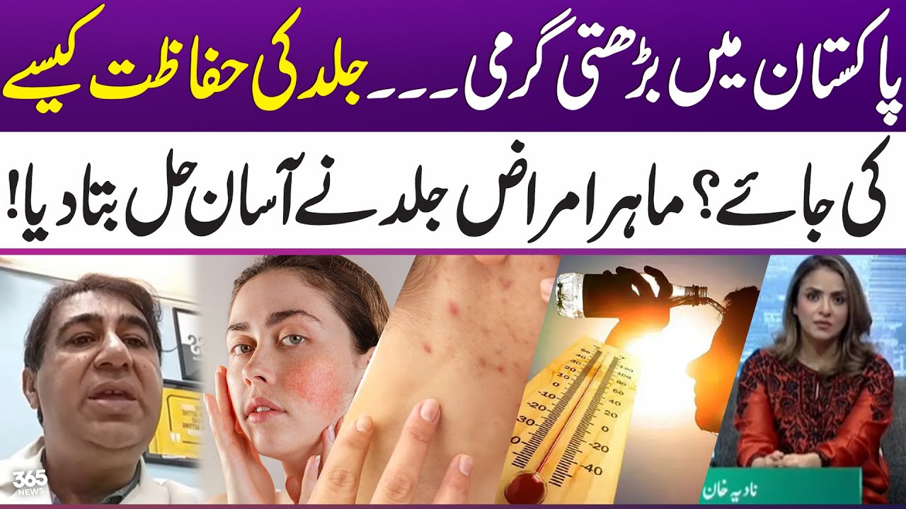 Rising Heat in Pakistan | How to protect your skin in summer? | Dermatologist shares Tips | 365 News
