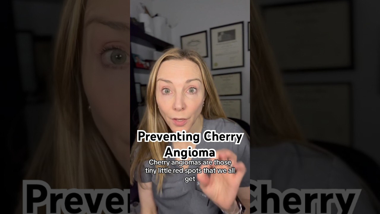 Вот как предотвратить вишневую ангиому 