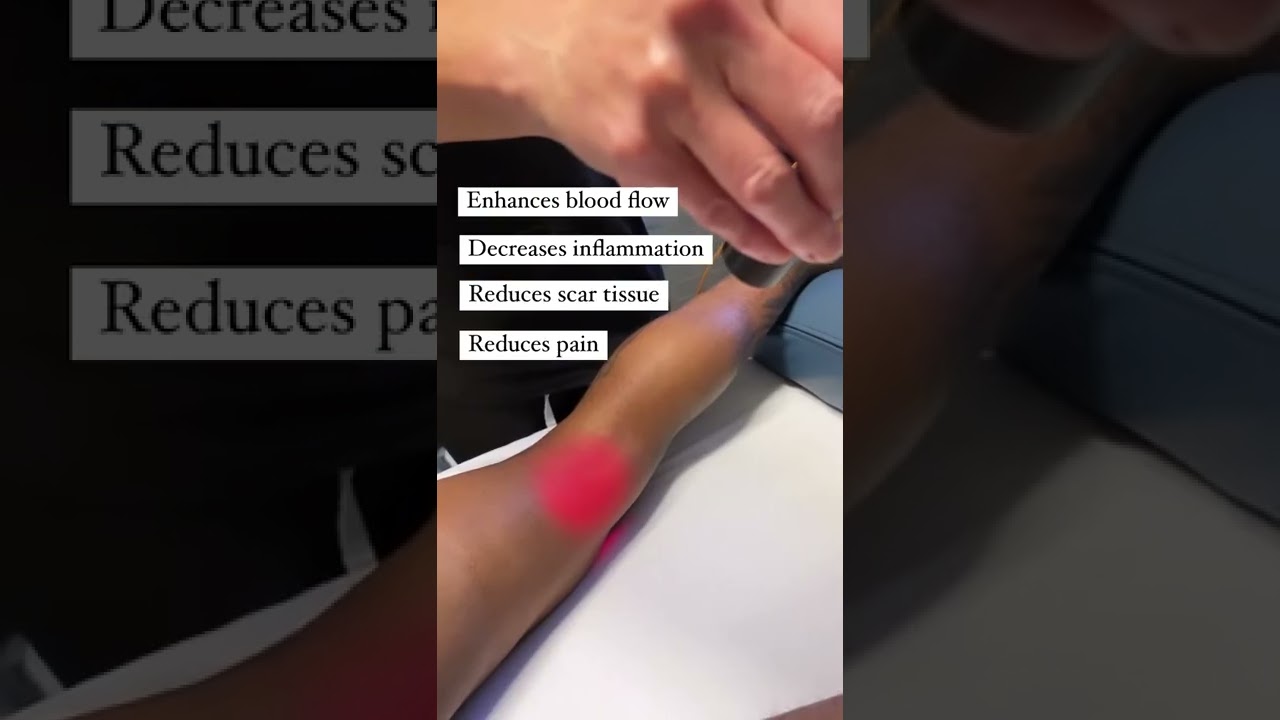 Reduce Pain from Muscle Strain or Injury Faster with Curewave Laser