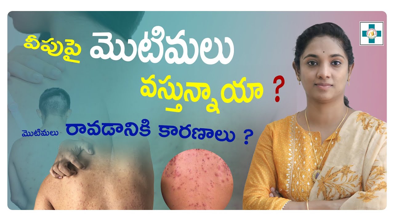 వీపుపై మొటిమలు వస్తున్నాయా ?||మొటిమలు రావడానికి కారణాలు ?|| Dr.Kavya Chennamsetty