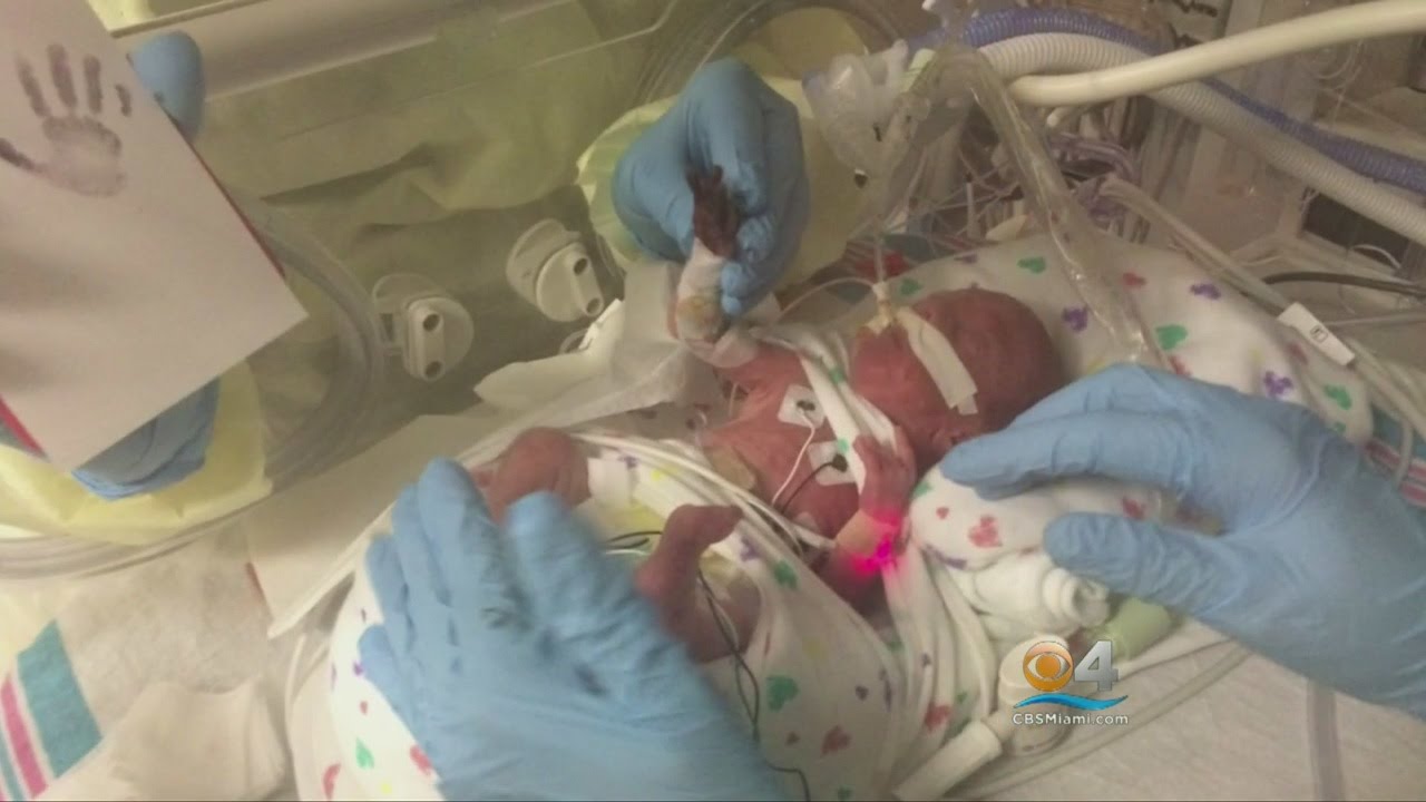 ‘Miracle Micro-Preemie’ Born On Caribbean Cruise