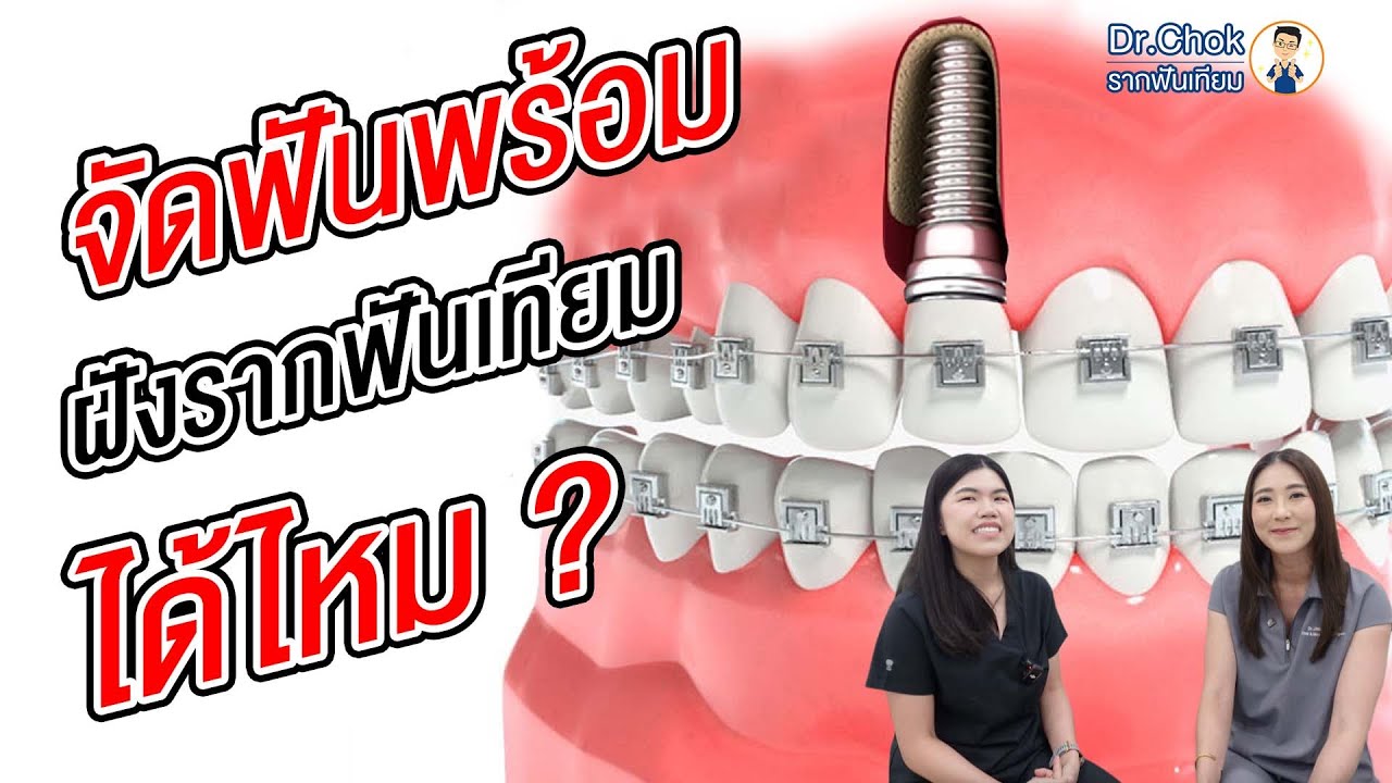 จัดฟันพร้อมฝังรากฟันเทียมได้ไหม ?!! | คลายปัญหารากฟันเทียมกับหมอโชค