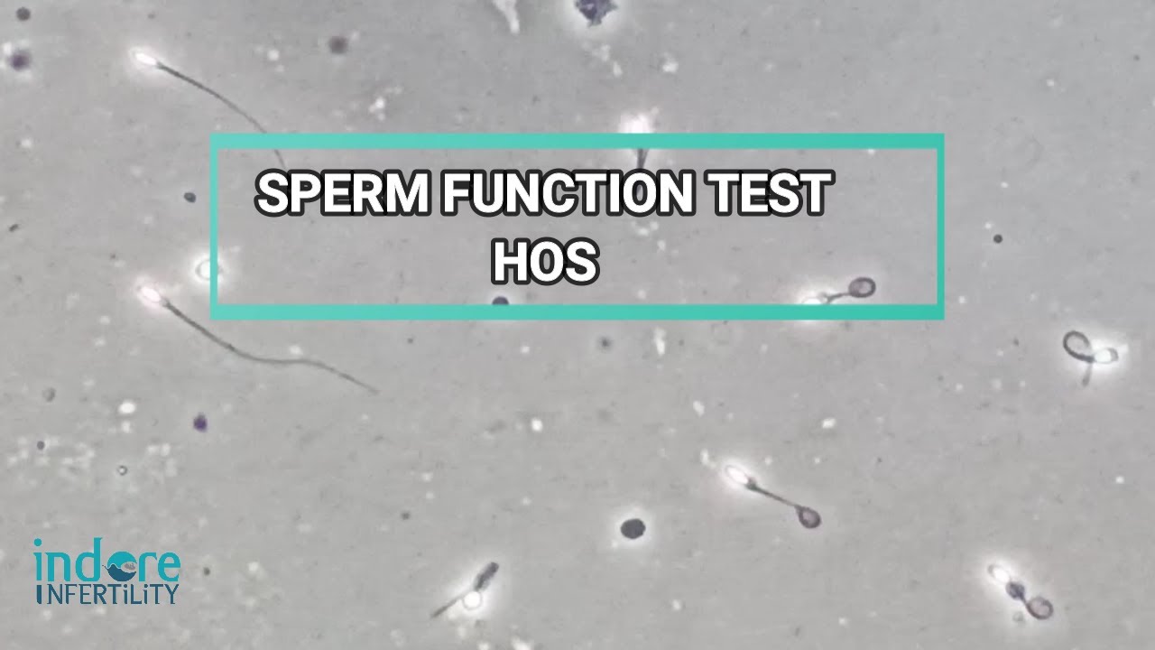 HOS - Hypo Osmotic Swelling is a Sperm Function Test / Measure of Sperm's Fertility Potential