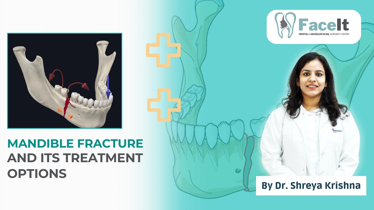 Mandible Fracture and Its Treatment Options | Jaw Fracture Repair Surgery by Dr. Shreya Krishna