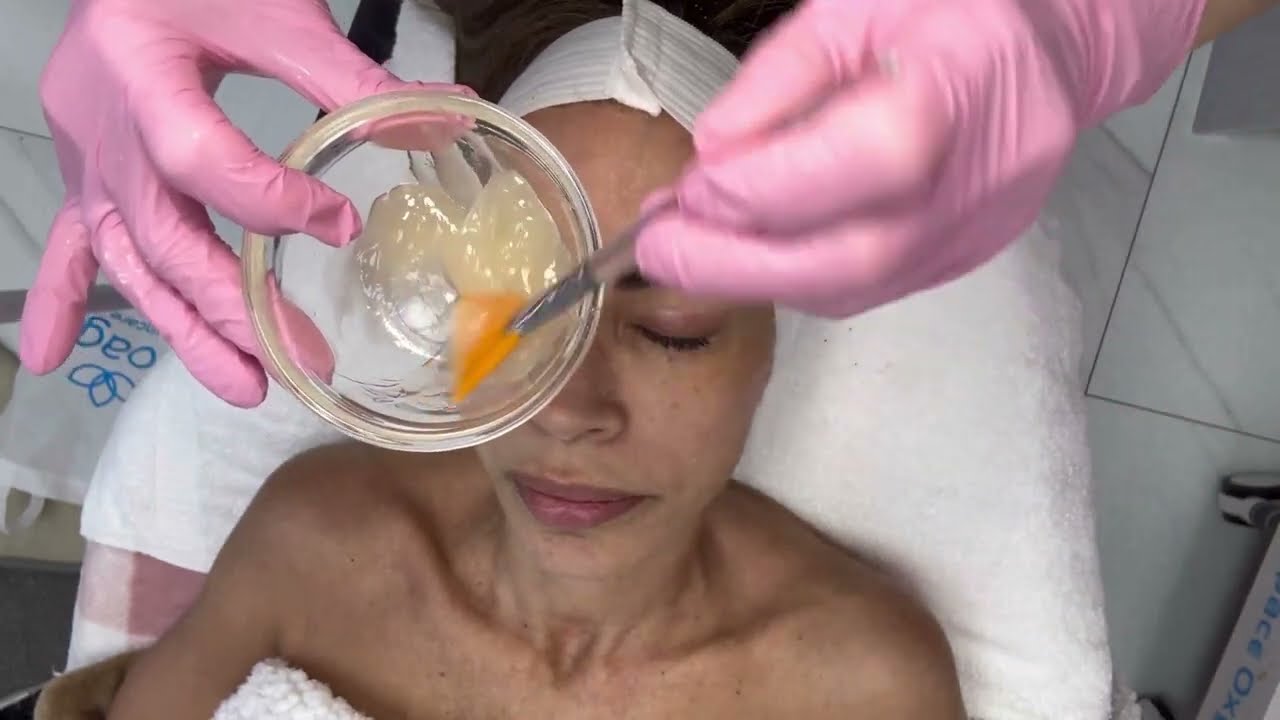 DEMO Revolutionary Non-Invasive Therapy: RibeSkin CO2 Carboxy Combo | Discover Its Benefits!