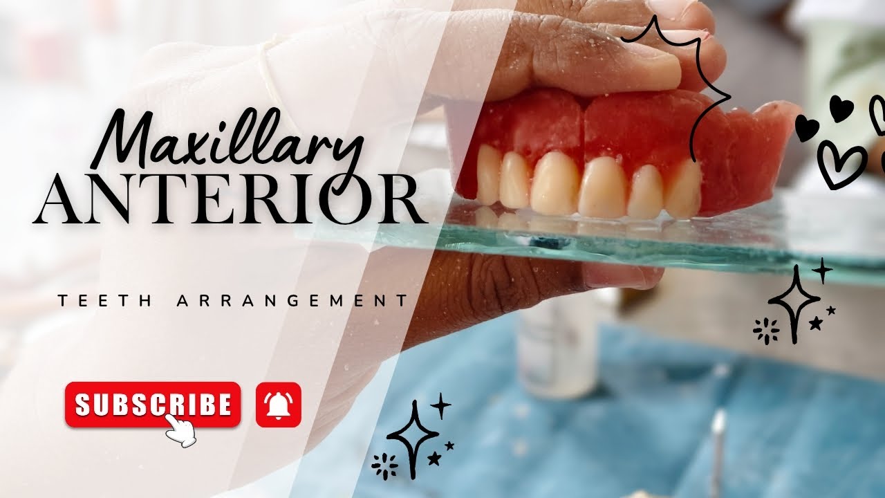 Maxillary Anterior Teeth Arrangement | Step-by-Step Demonstration 