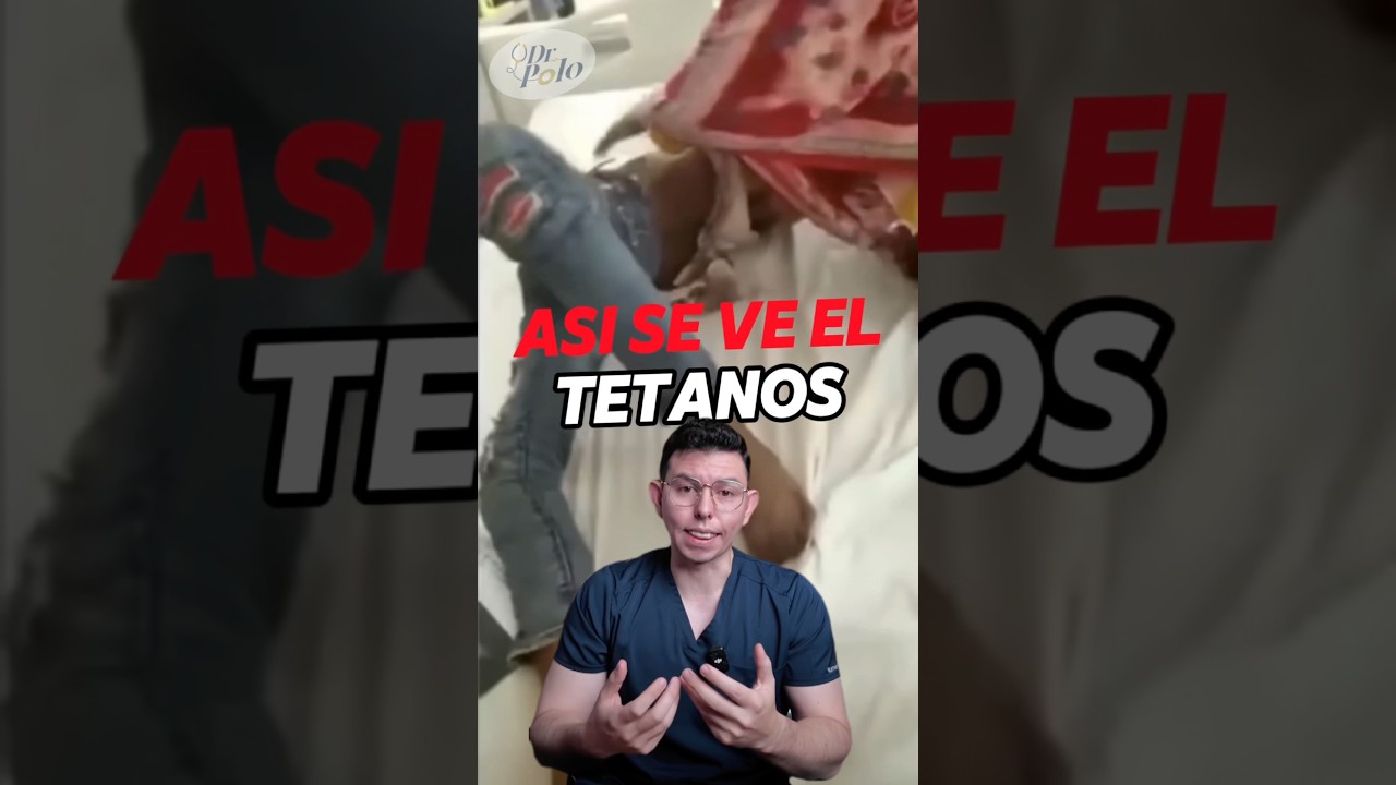 AS&Iacute; se ve el TET&Aacute;NOS!! 🥹 (CUIDADO) m&aacute;s en IG #medicina #sabiasque #curiosidades