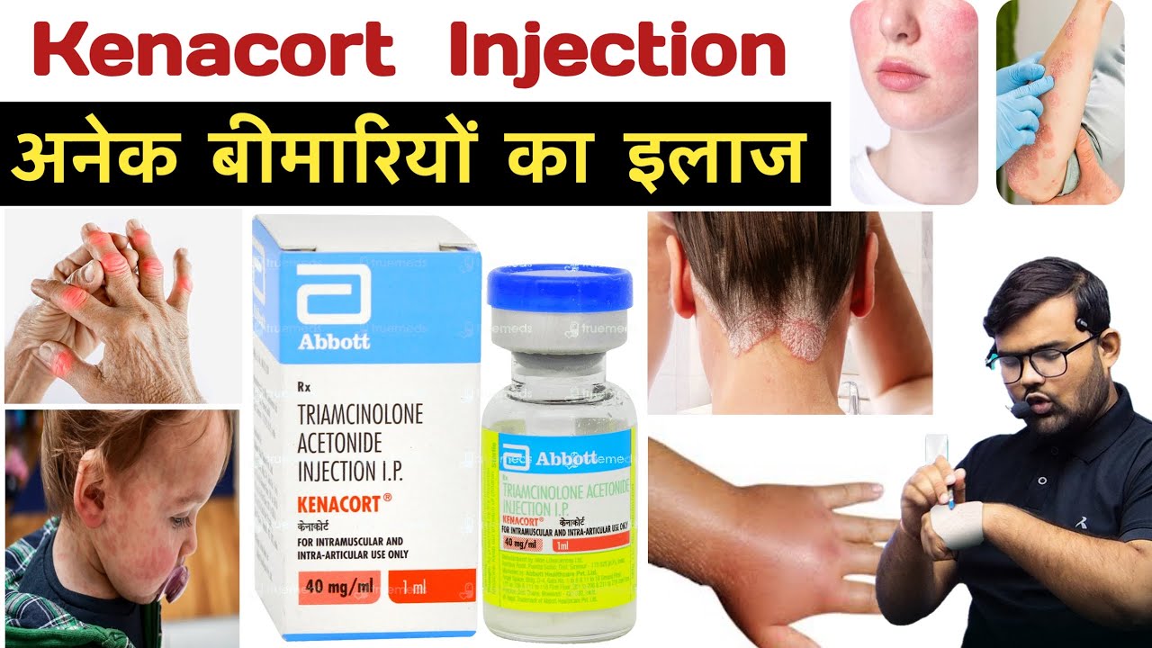 Kenacort Injection | Medicine | Treatment | Pharmacy | Doctor | MBBS | Nursing | BHMS | BAMS | BUMS