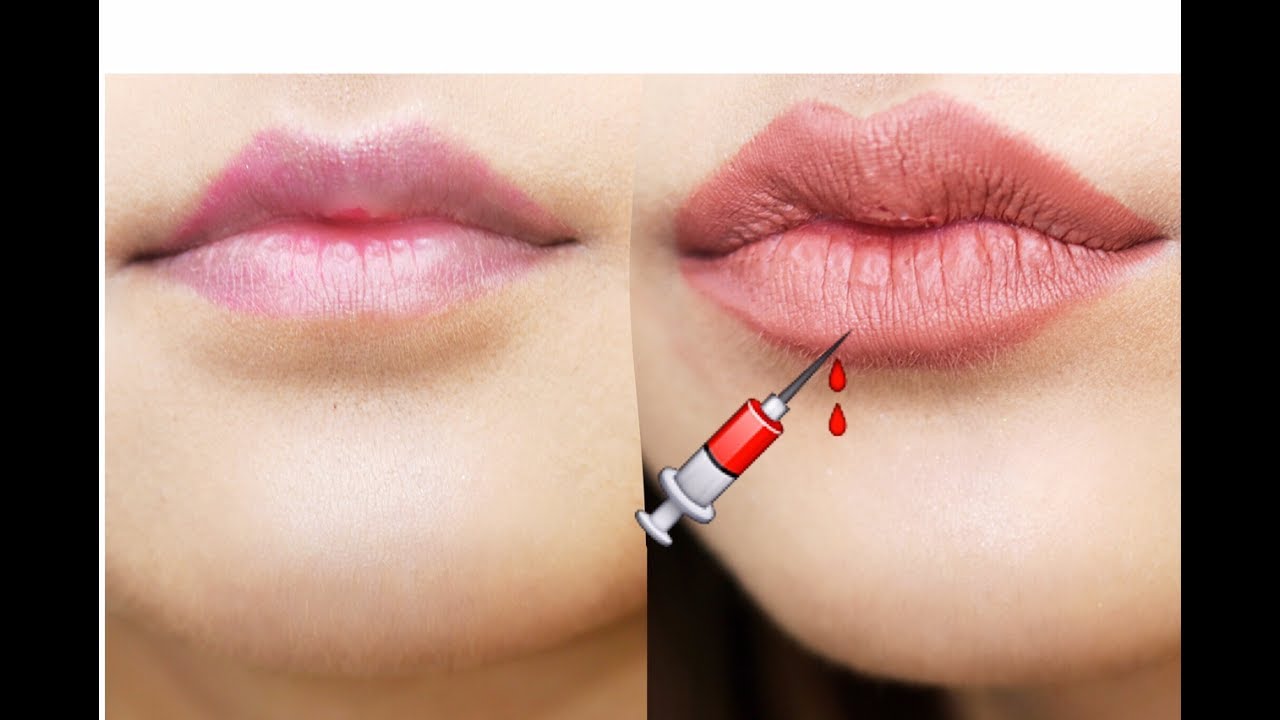 How to make your LIPS look BIGGER?? | Fake a lip job
