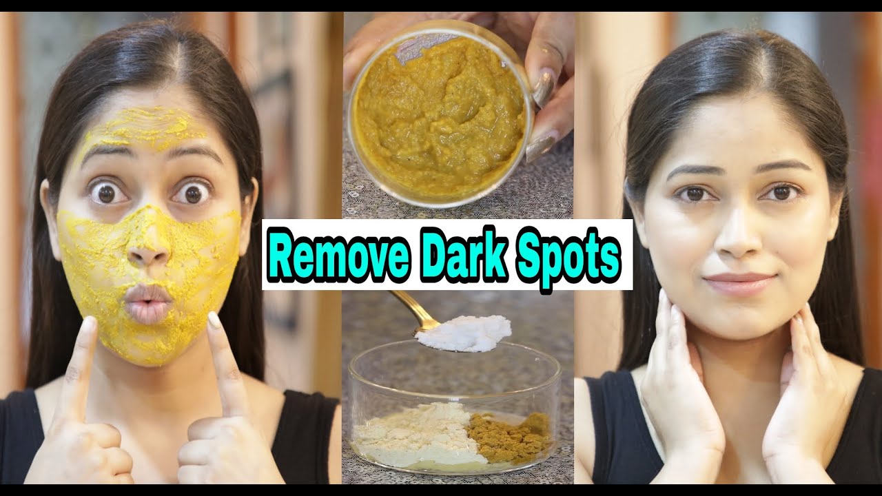 😱सिर्फ Rs5 में आलू🥔से Remove Dark Spots,Pigmentation Most Effective Diy & Beauty Drink🍵|Be Natural