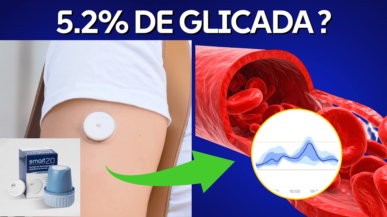 5.2% de glicada aos 83 anos? O SENSOR mudou tudo!