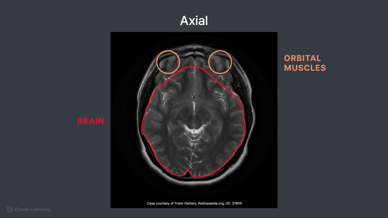 Patient Positioning and Protocol for a Routine Brain MRI