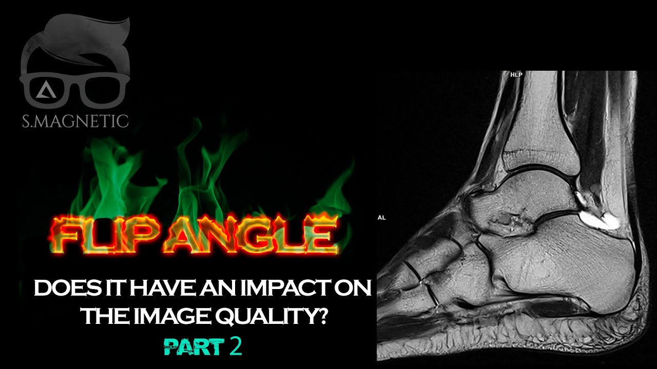 FLIP ANGLE – DOES IT HAVE AN IMPACT ON THE IMAGE QUALITY? PART 2