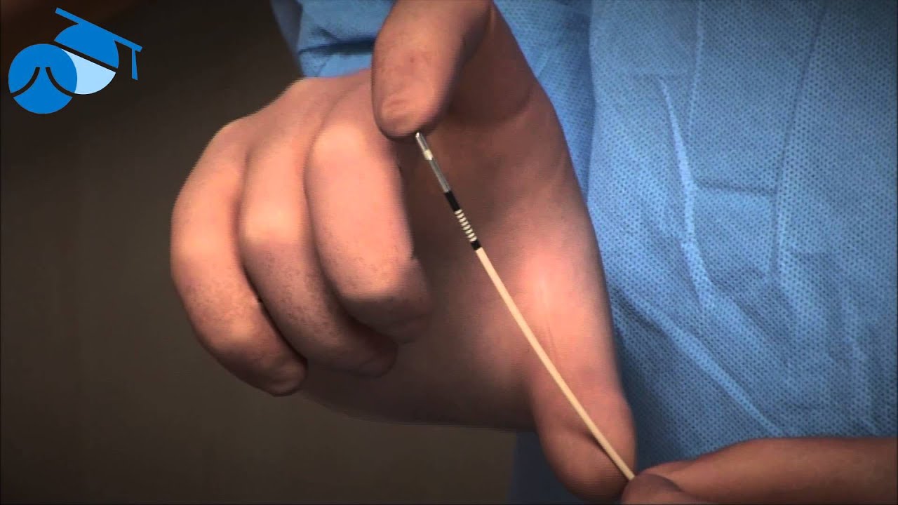 Explanation of Radiofrequency Ablation (RFA) of varicose veins