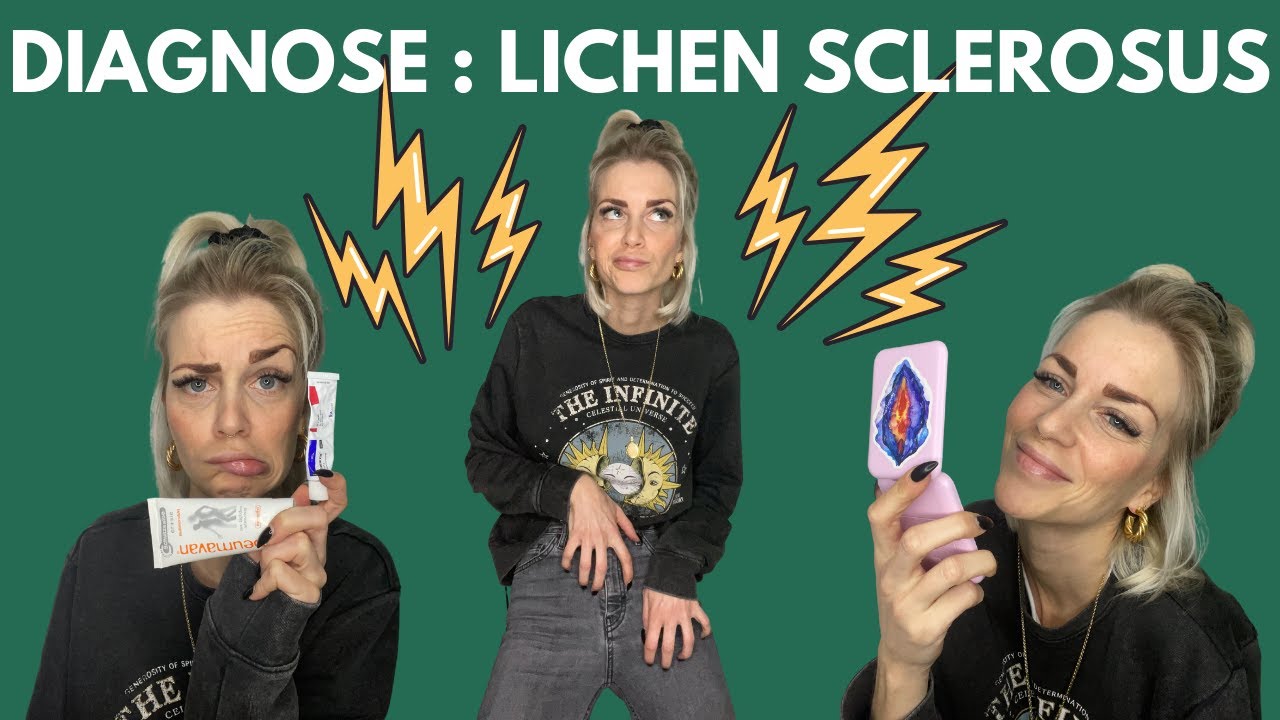 Diagnose: Lichen Sclerosus