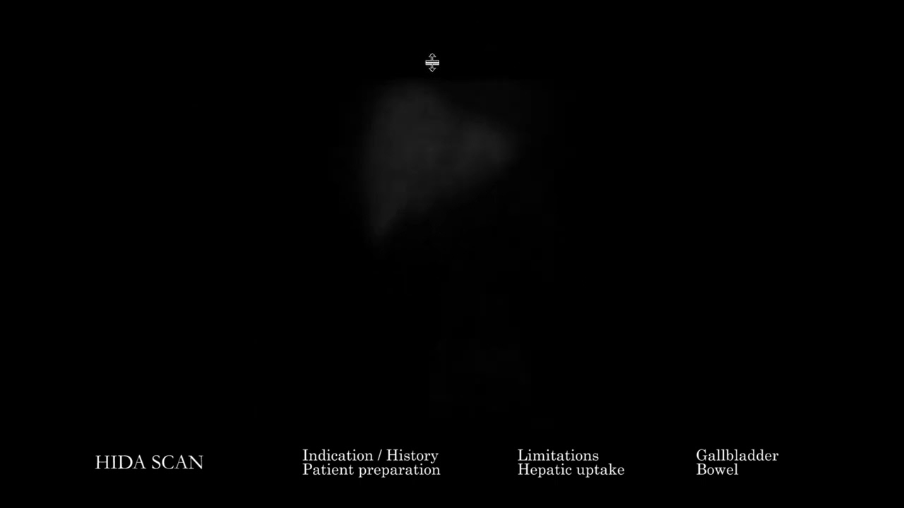 [NM] HIDA Scan (Hepatobiliary Scintigraphy) | Search Pattern