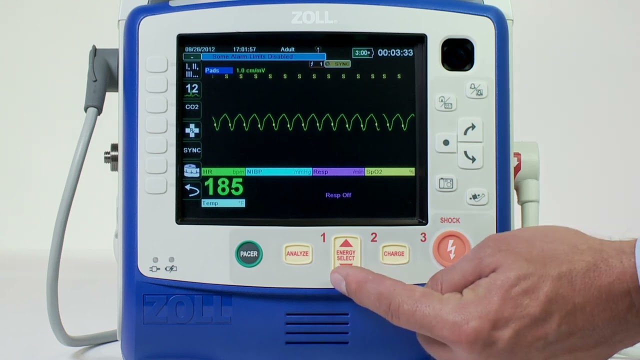 X Series&reg;: Synchronized Cardioversion (English)