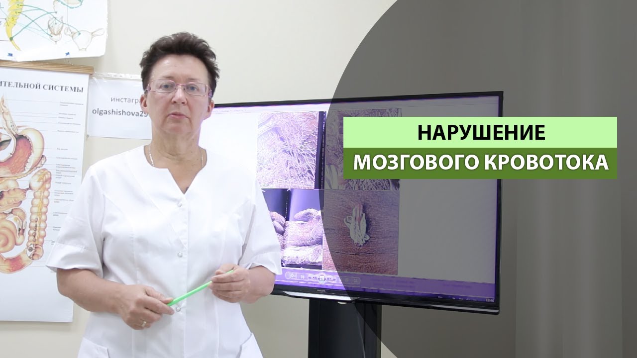 НАРУШЕНИЕ МОЗГОВОГО КРОВОТОКА