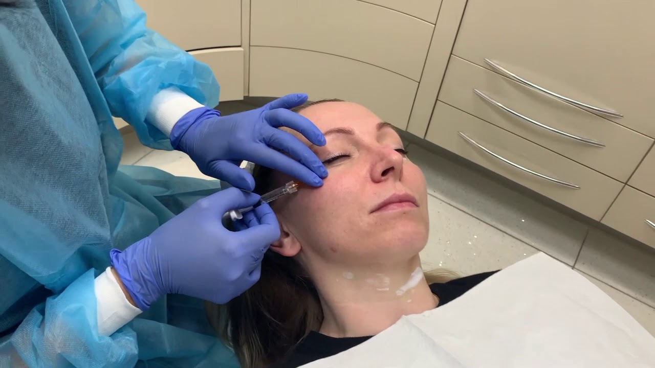 Viscoderm eye rejuvenation