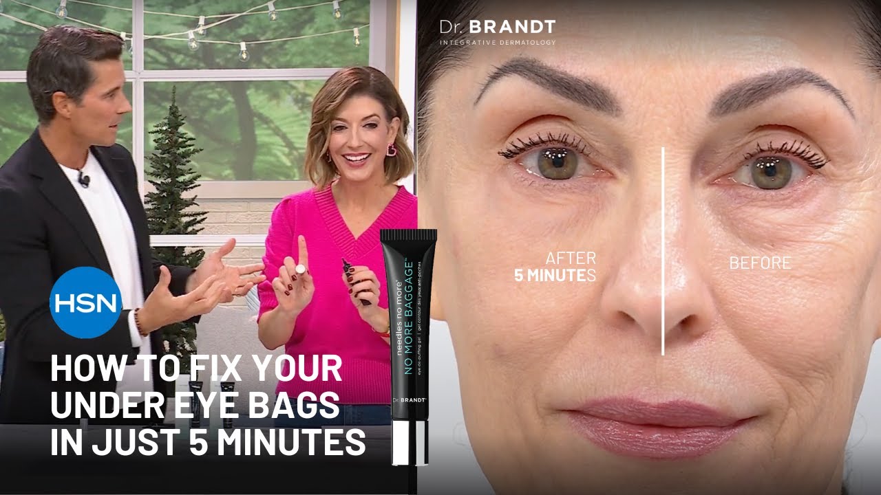 How To Fix Your Dark Under Eye Bags in Just 5 Minutes