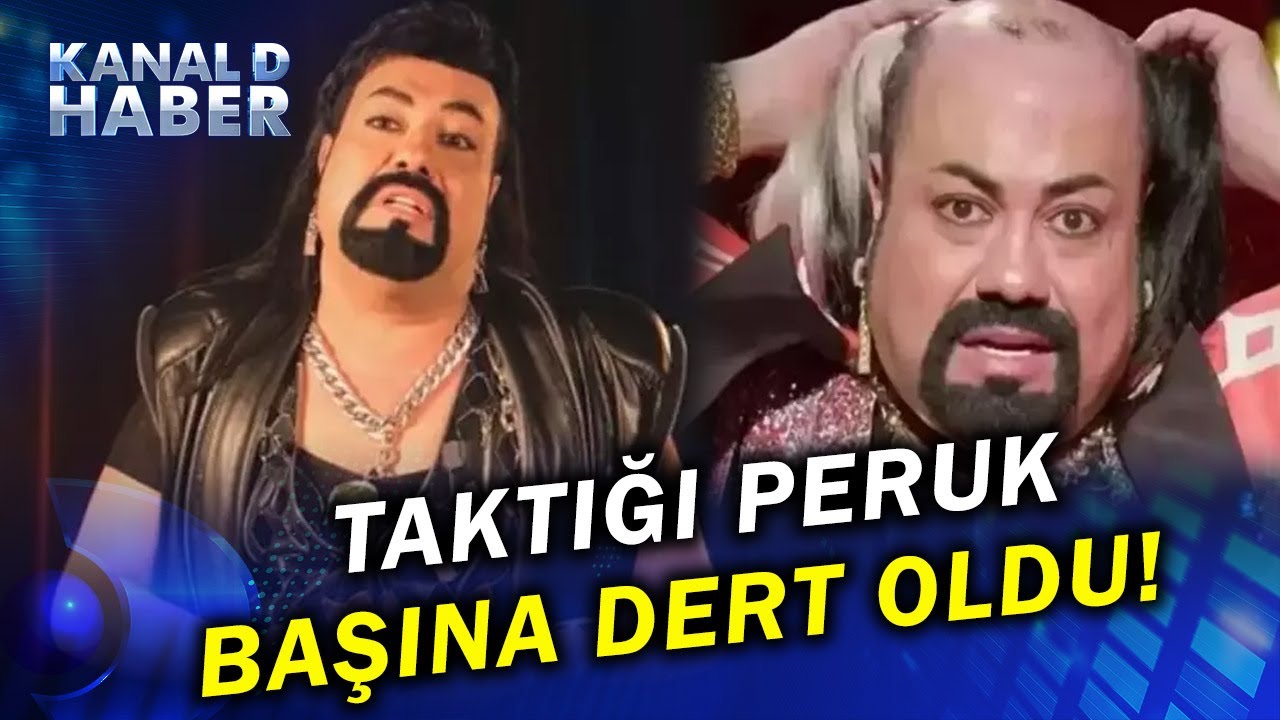Protez Saçtaki Gizli Tehlike: O Saç Kobra Murat'ın Başına İş Açtı...