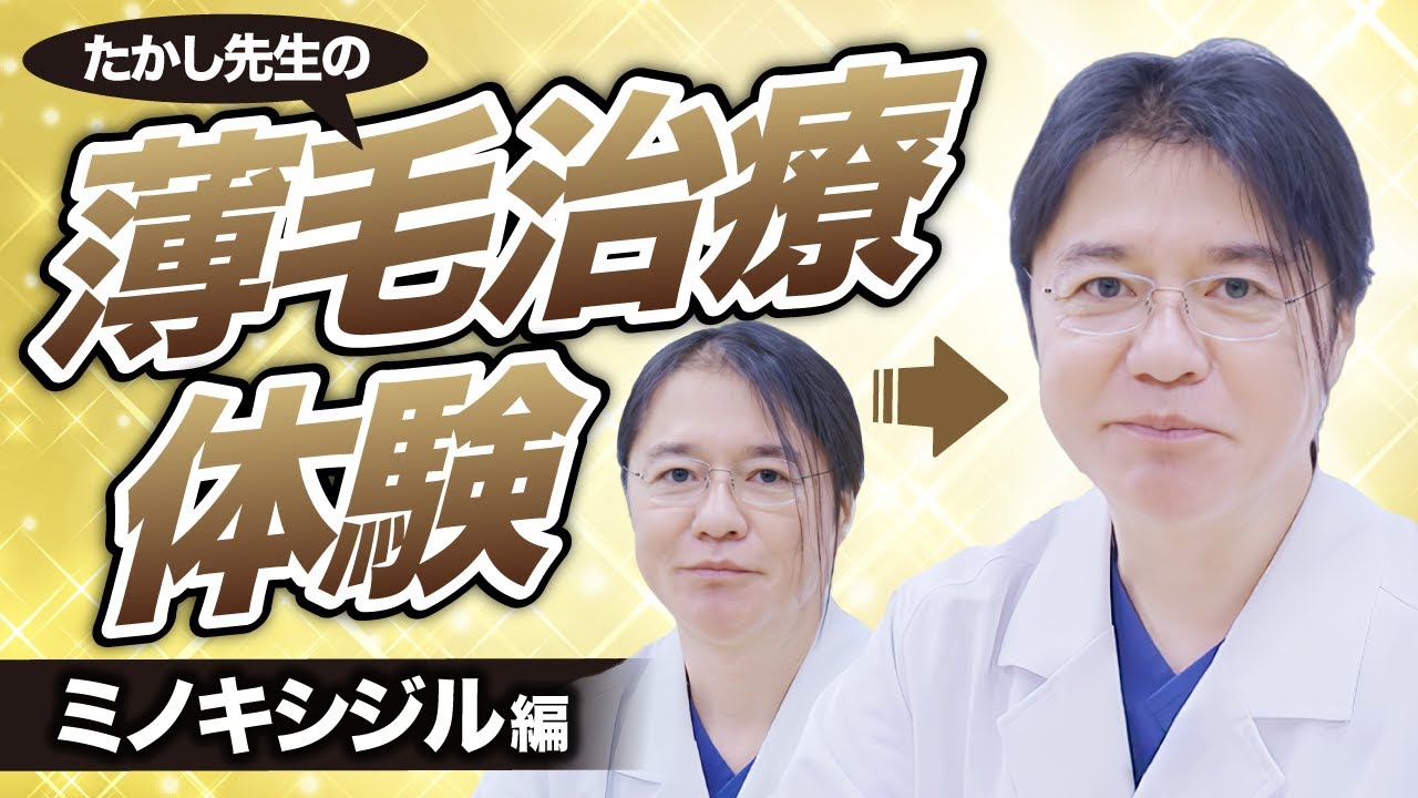 【薄毛】実際に医師が薄毛治療を体験してみた！その効果と副作用を徹底解説！！【ミノキシジル編】