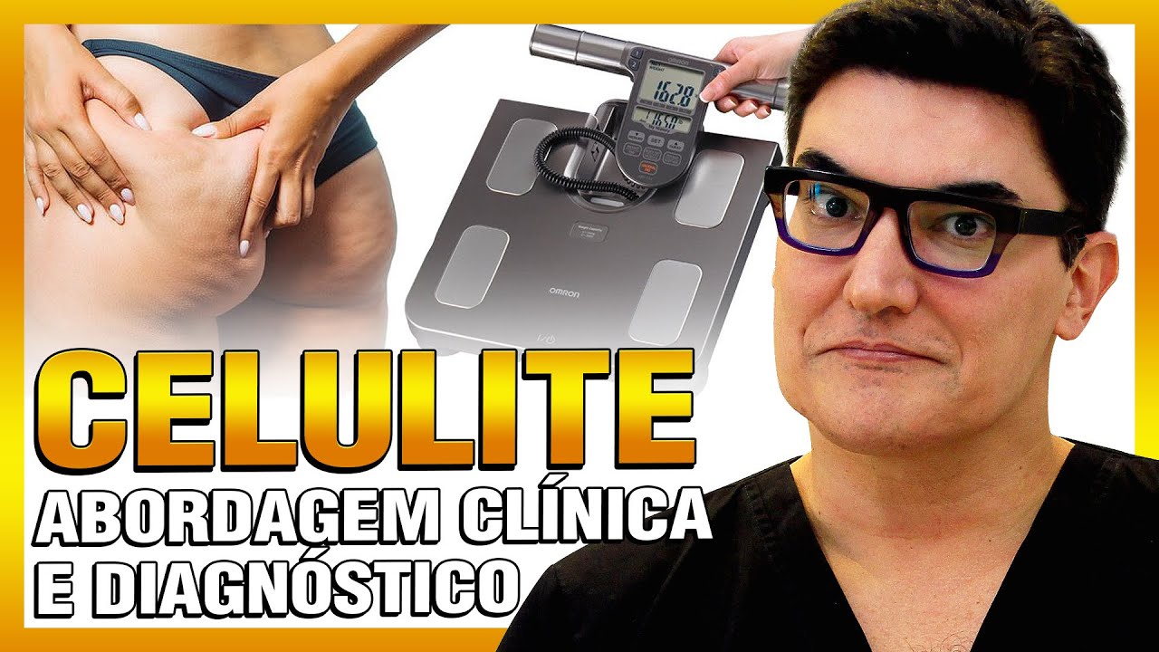 Celulite: Abordagem Clínica e Diagnóstico | Aula 2/4