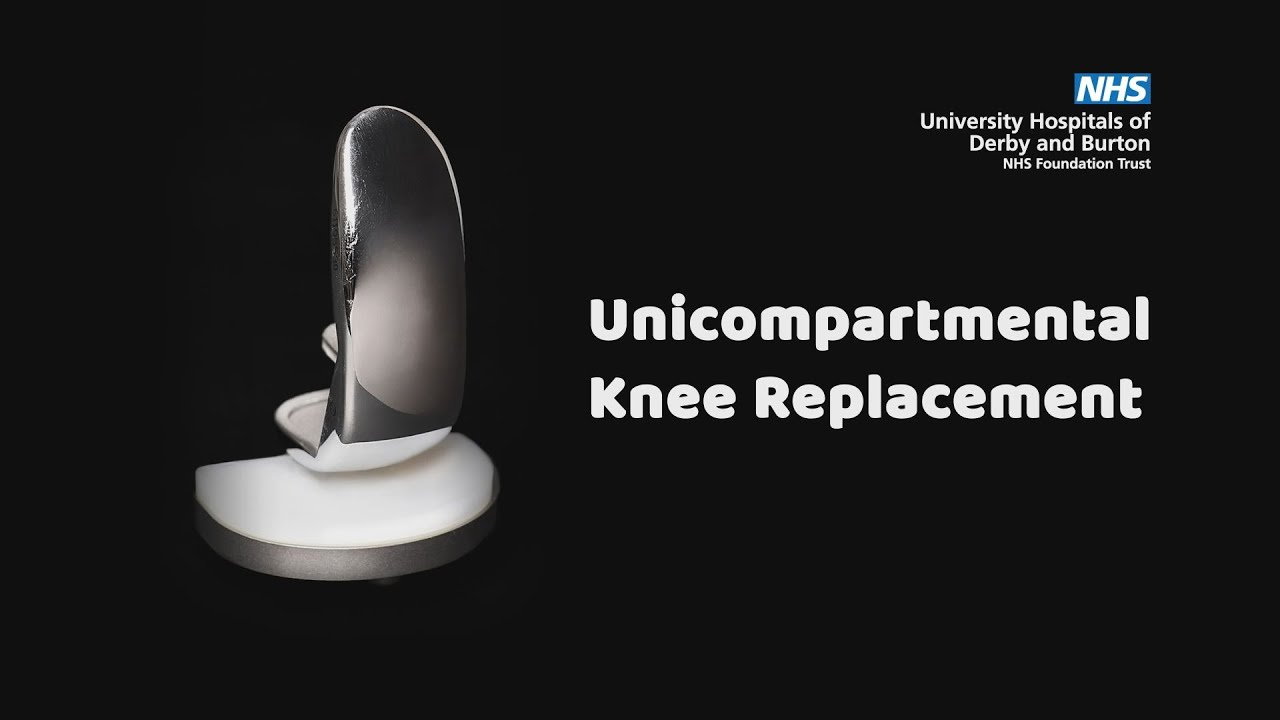 Derby Day Case Pathway for Unicompartmental Knee Replacement