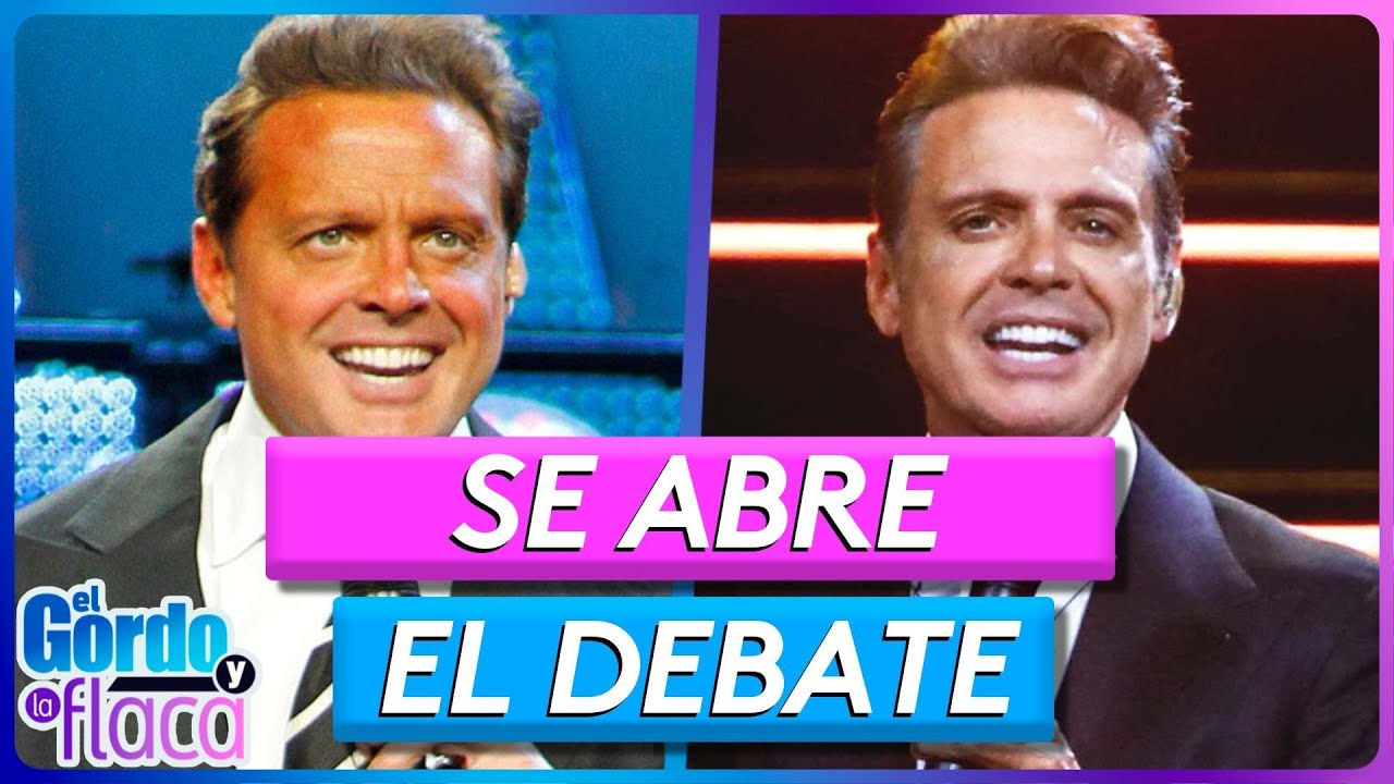 Expertos explican si Luis Miguel pasó por el quirófano o tiene un doble | El Gordo Y La Flaca