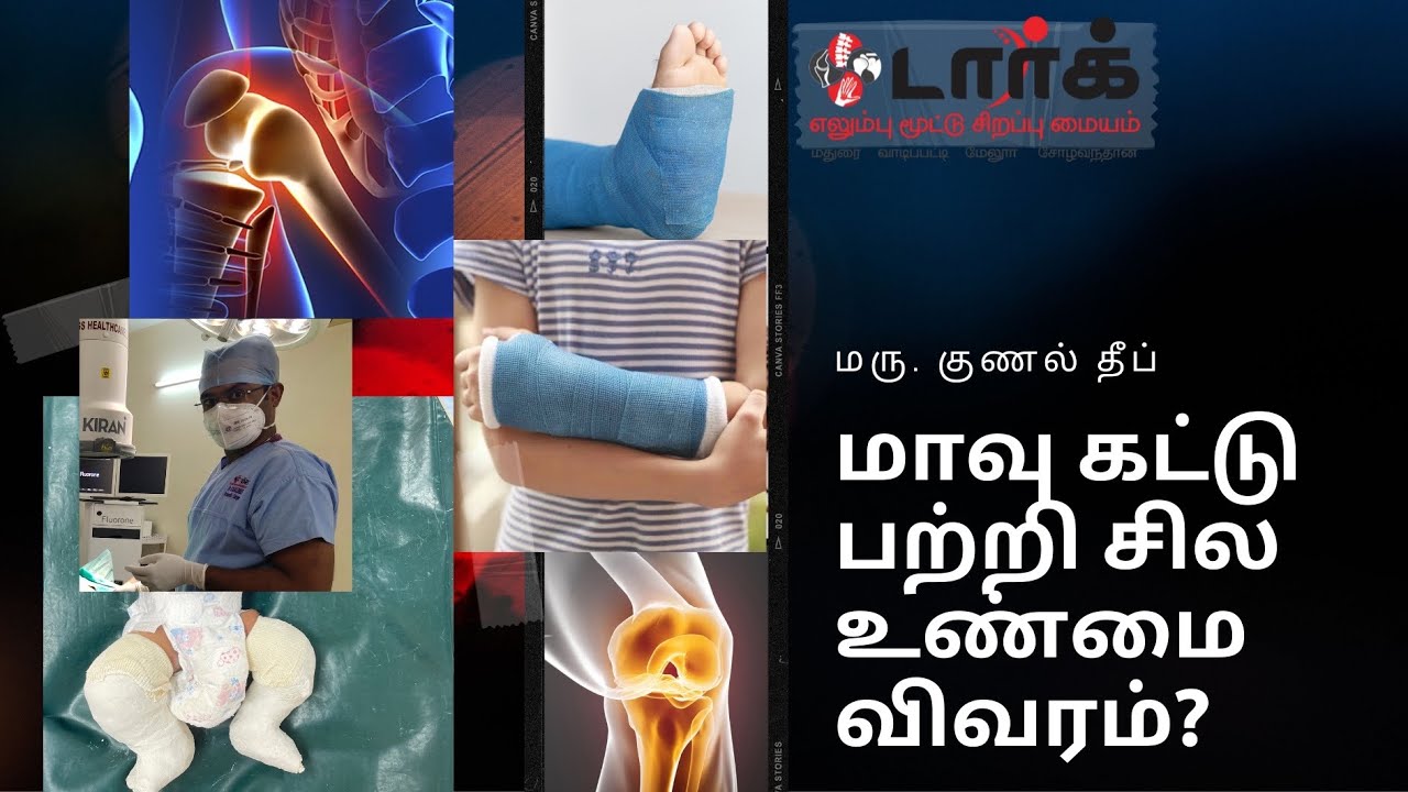 மாவு கட்டு பற்றி சில உண்மை விவரங்கள்|எலும்பு சேருவது எப்படி? டார்க் மருத்துவர் dr. குணல் தீப்.