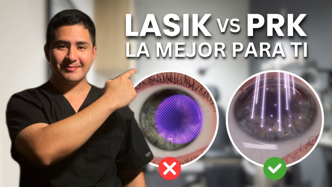 PRK vs LASIK: Doctor EXPLICA CUAL es la MEJOR OPCION 🤔
