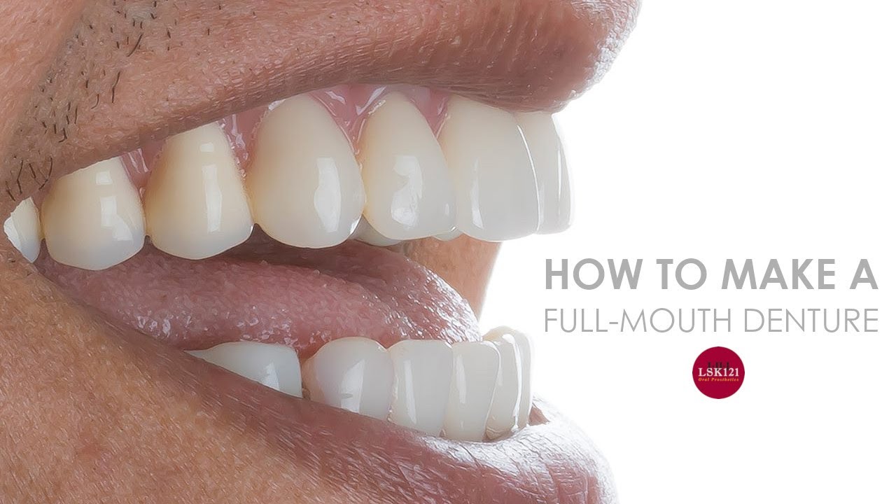 How To Make a Full Denture Start To Finish
