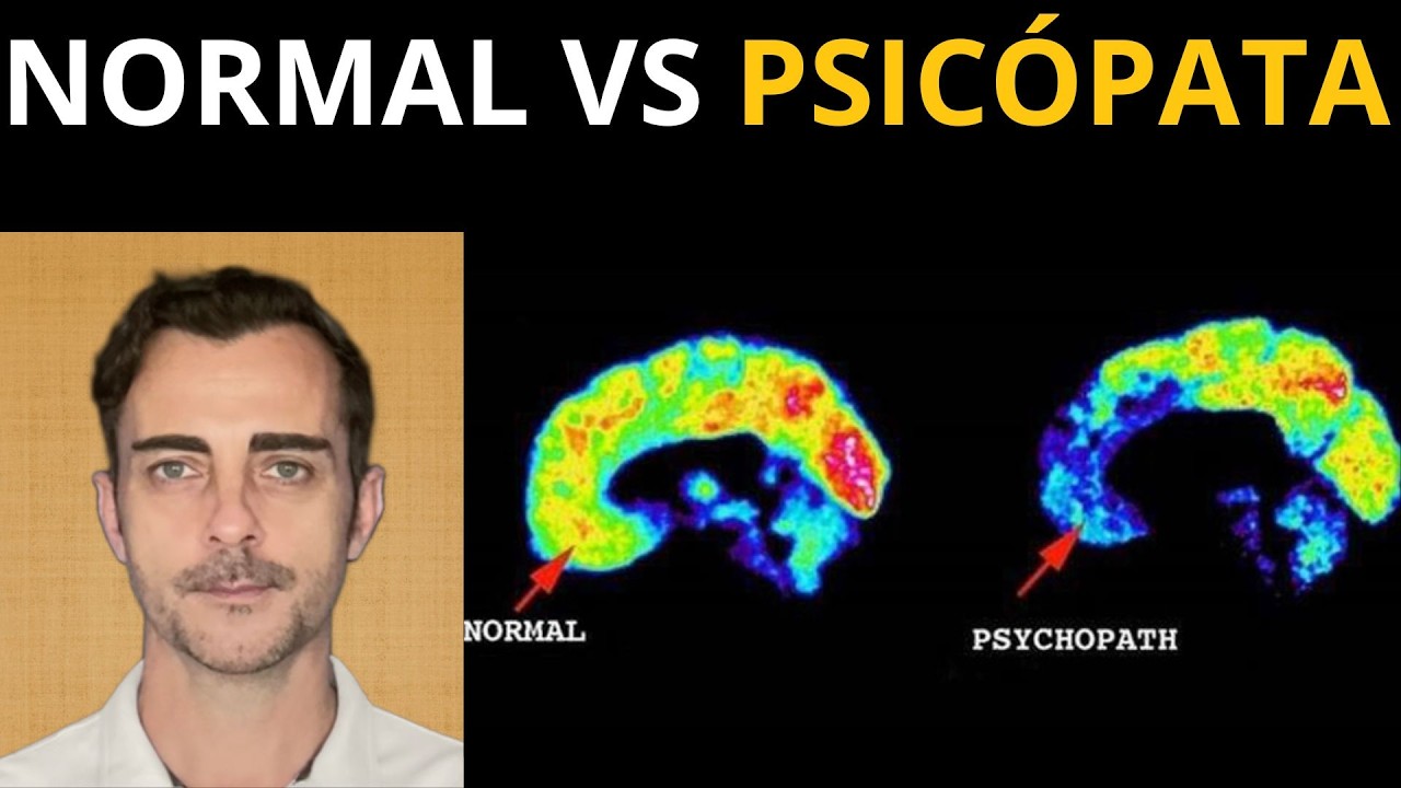 El cerebro psicópata