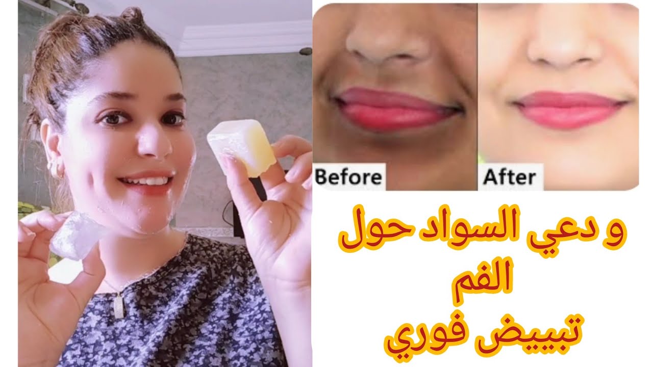 أقوى وصفة لإزالة السواد حول الفم مهما كان الاسمرار في دقائق و النتيجة رائعة جدا بعد أول استعمال