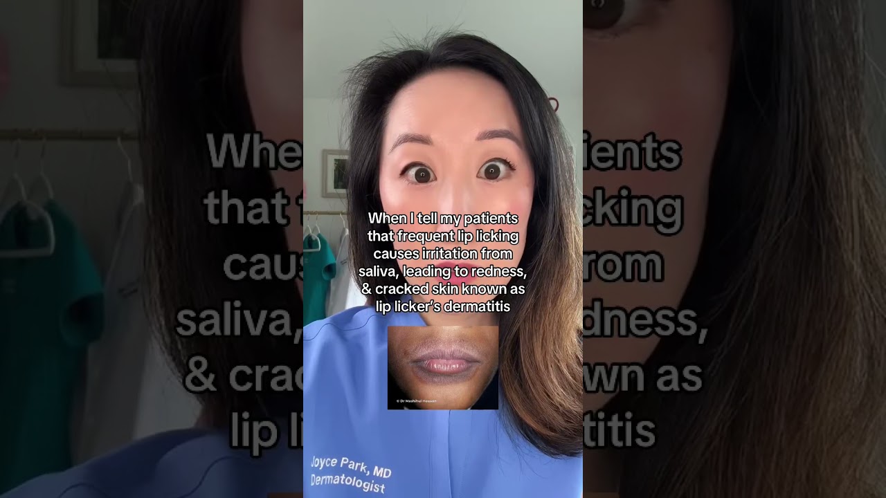 How to Heal Lip Licker&rsquo;s Dermatitis