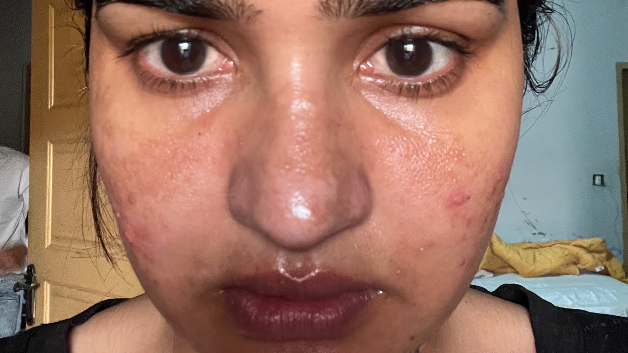 Tretinoin + Niacinamide Skincare Routine | Clear, Glowing Skin Without Irritation Beginner Friendly