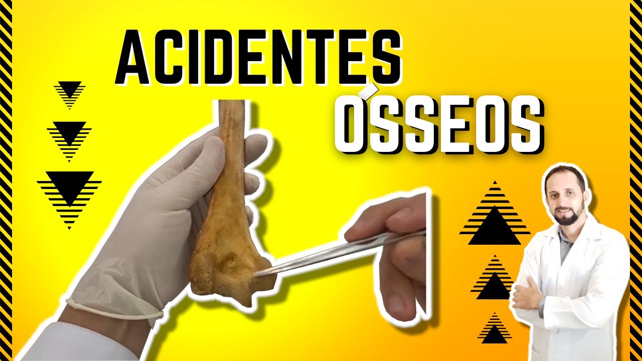 Nomenclatura dos Acidentes &oacute;sseos - Sistema esquel&eacute;tico