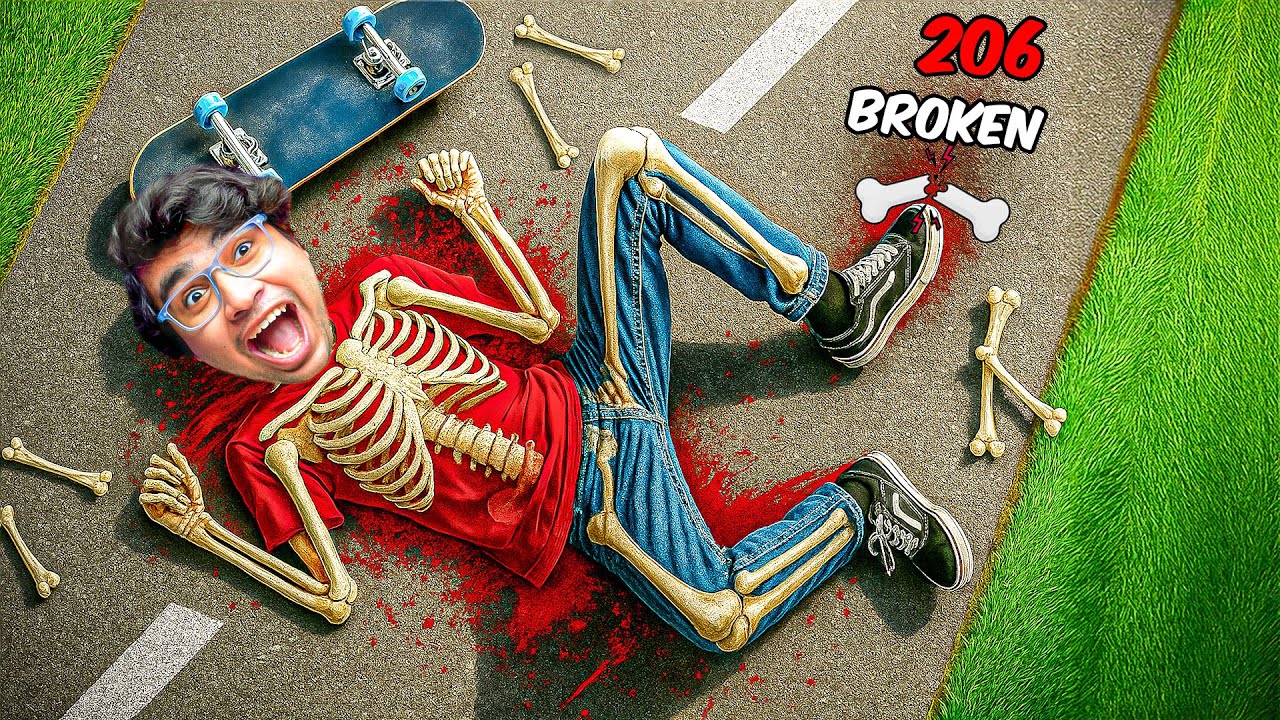 Breaking ALL My BONES on a Skateboard! 💀🛹