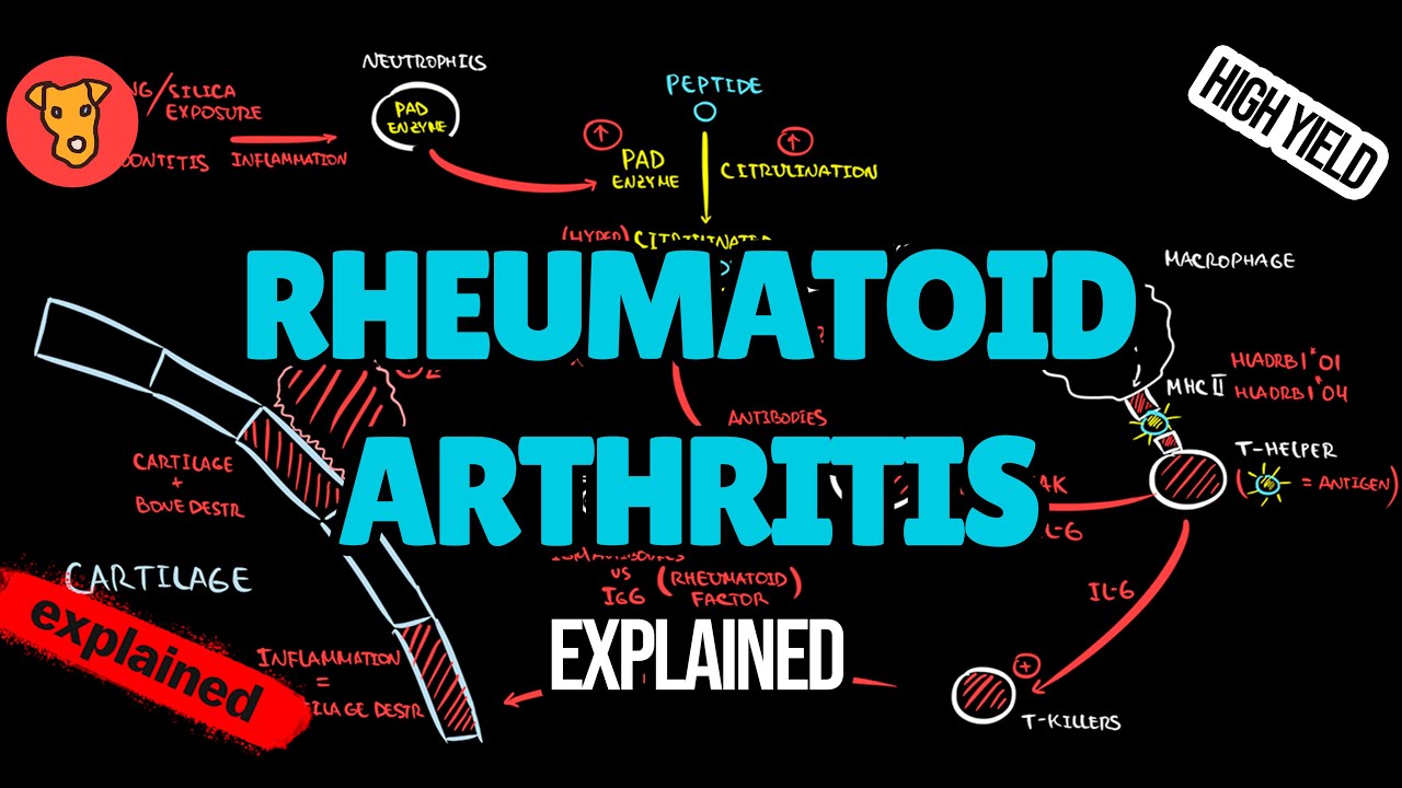 Rheumatoid Arthritis EXPLAINED: Pathogenesis, EULAR Guidelines, Diagnosis & X-Ray (USMLE)