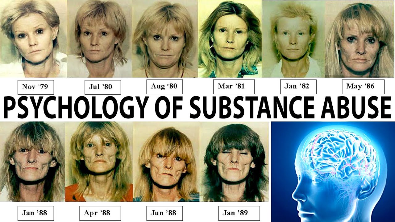 Psychology of Drug Addiction & Substance Abuse Disorder, Causes & Solutions