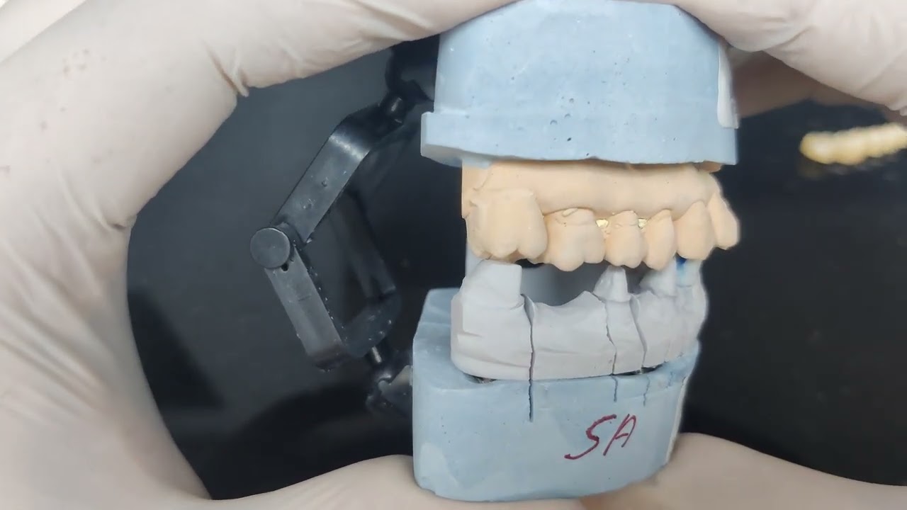 ProsthoTip: Wrong Articulator #occlusion #fixedprostho