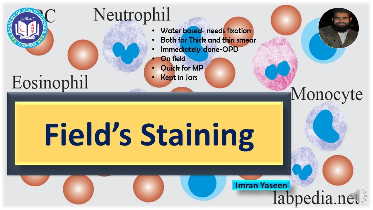 Field's stain: Water based Romanowsky stains needs fixation | Hematology | by Imran Yaseen