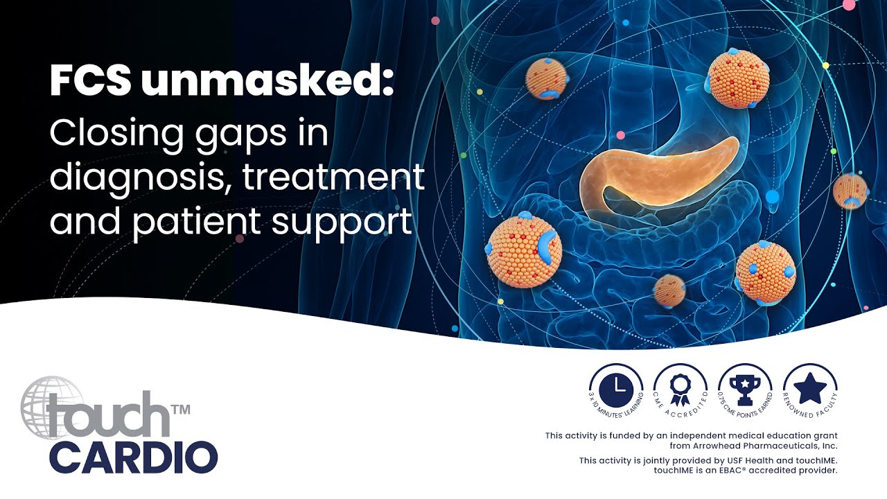 FCS unmasked: Closing Gaps in diagnosis, treatment and patient support